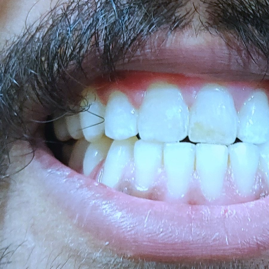 Quality Dental Cares - Quality Dental Cares