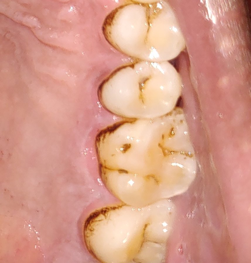 Quality Dental Cares - Quality Dental Cares