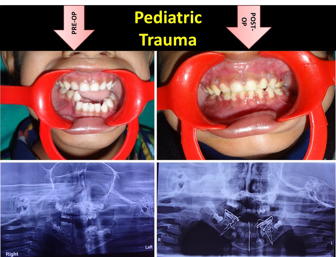 R D DENTAL HOSPITAL & RESEARCH CENTRE - R D DENTAL HOSPITAL & RESEARCH CENTRE