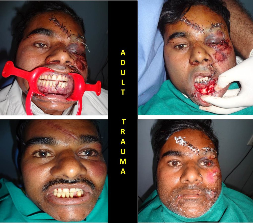 R D DENTAL HOSPITAL & RESEARCH CENTRE - R D DENTAL HOSPITAL & RESEARCH CENTRE