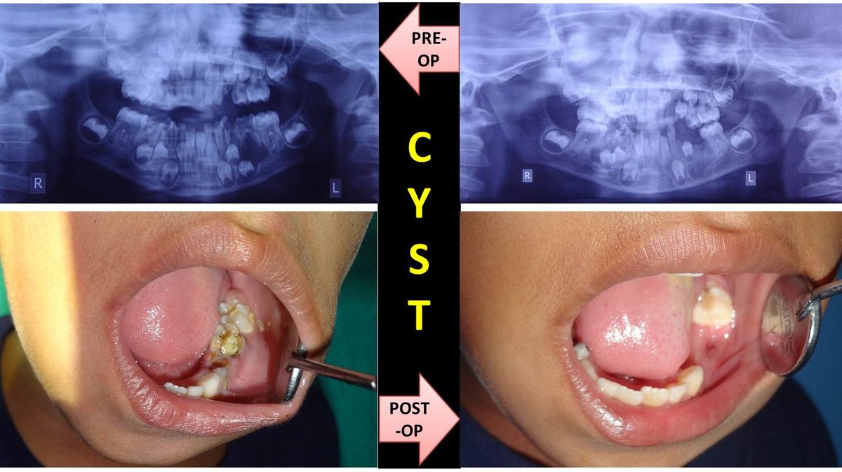 R D DENTAL HOSPITAL & RESEARCH CENTRE - R D DENTAL HOSPITAL & RESEARCH CENTRE