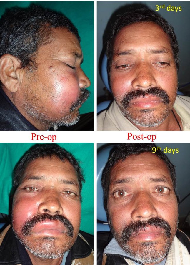 R D DENTAL HOSPITAL & RESEARCH CENTRE - R D DENTAL HOSPITAL & RESEARCH CENTRE
