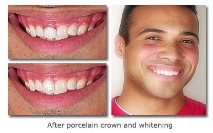 Radiant Smiles Dental: Wu Grace E DDS - Radiant Smiles Dental: Wu Grace E DDS