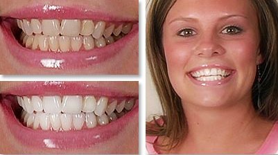 Radiant Smiles Dental: Wu Grace E DDS - Radiant Smiles Dental: Wu Grace E DDS