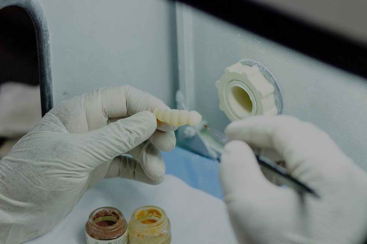 Raga Dental Center for Dental Implants & Laser - Raga Dental Center for Dental Implants & Laser