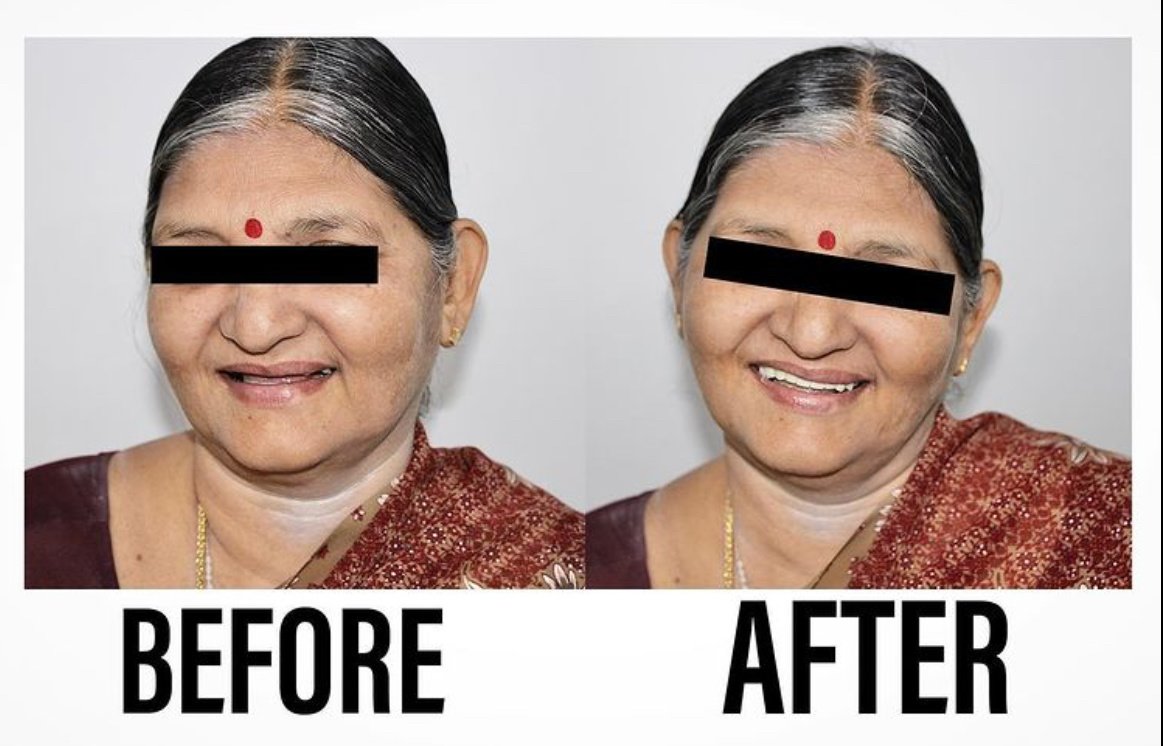 Raga Dental Center for Dental Implants & Laser - Raga Dental Center for Dental Implants & Laser