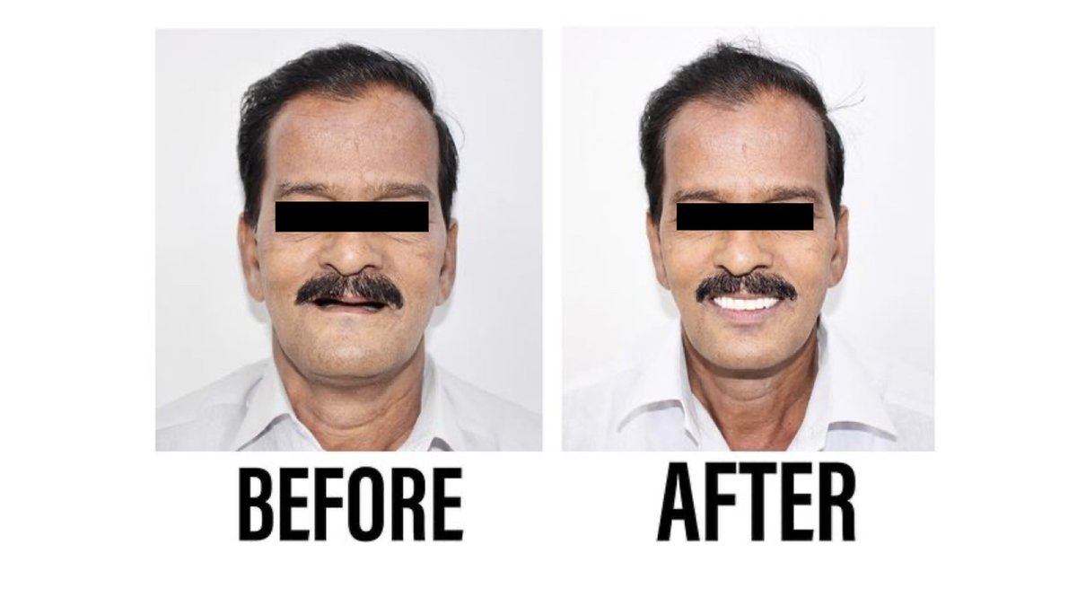 Raga Dental Center for Dental Implants & Laser - Raga Dental Center for Dental Implants & Laser