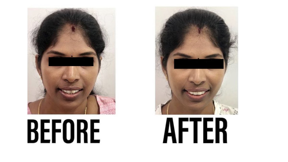 Raga Dental Center for Dental Implants & Laser - Raga Dental Center for Dental Implants & Laser