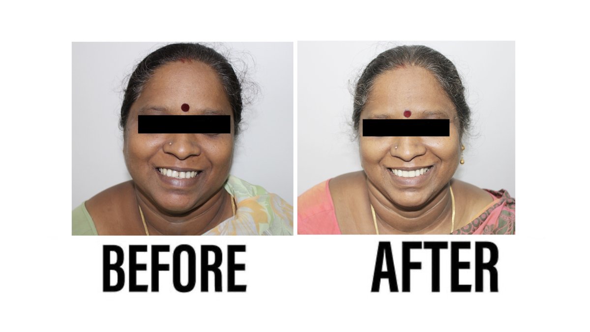 Raga Dental Center for Dental Implants & Laser - Raga Dental Center for Dental Implants & Laser