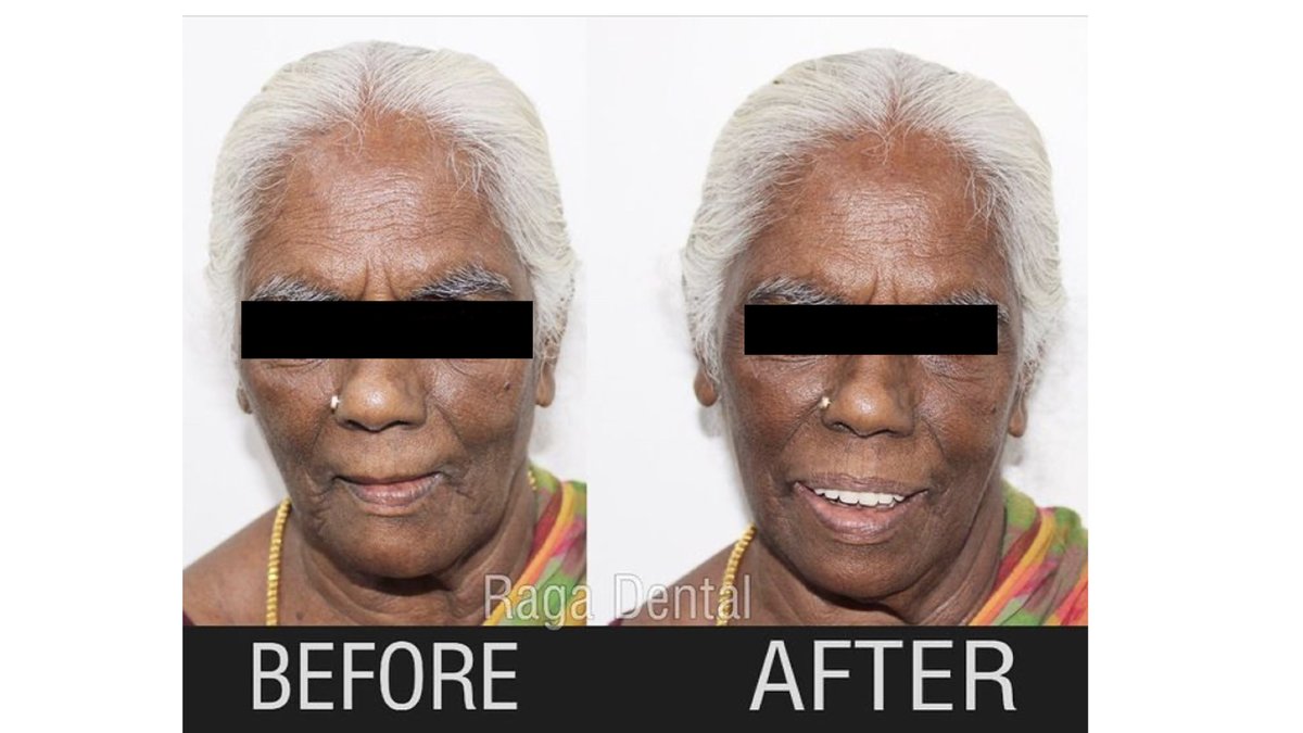 Raga Dental Center for Dental Implants & Laser - Raga Dental Center for Dental Implants & Laser