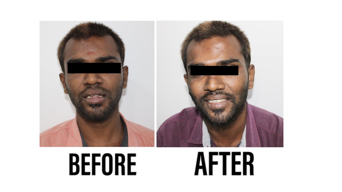 Raga Dental Center for Dental Implants & Laser - Raga Dental Center for Dental Implants & Laser