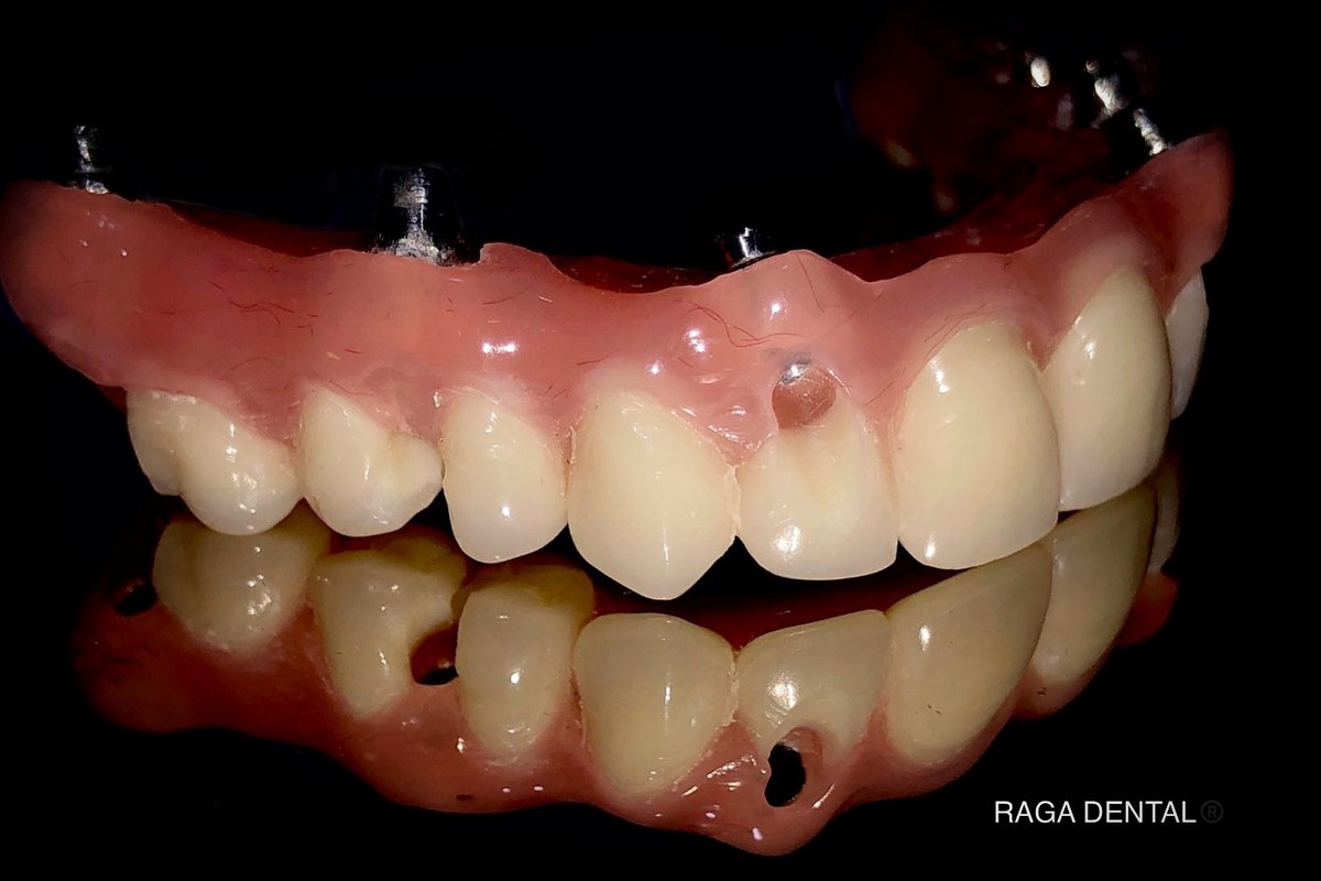 Raga Dental Center for Dental Implants & Laser - Raga Dental Center for Dental Implants & Laser