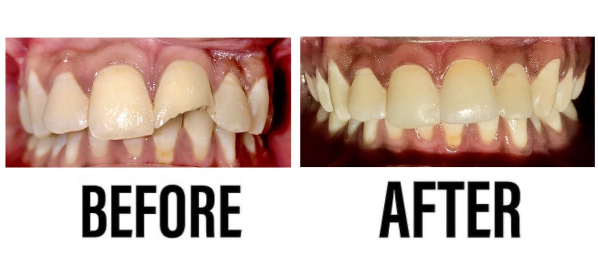 Raga Dental Center for Dental Implants & Laser - Raga Dental Center for Dental Implants & Laser