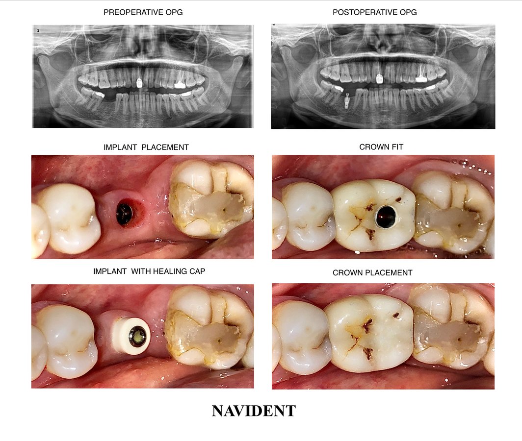 Raga Dental Center for Dental Implants & Laser - Raga Dental Center for Dental Implants & Laser