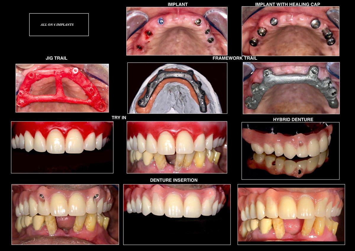Raga Dental Center for Dental Implants & Laser - Raga Dental Center for Dental Implants & Laser