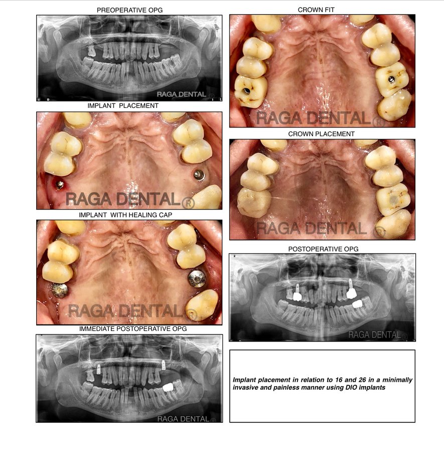 Raga Dental Center for Dental Implants & Laser - Raga Dental Center for Dental Implants & Laser