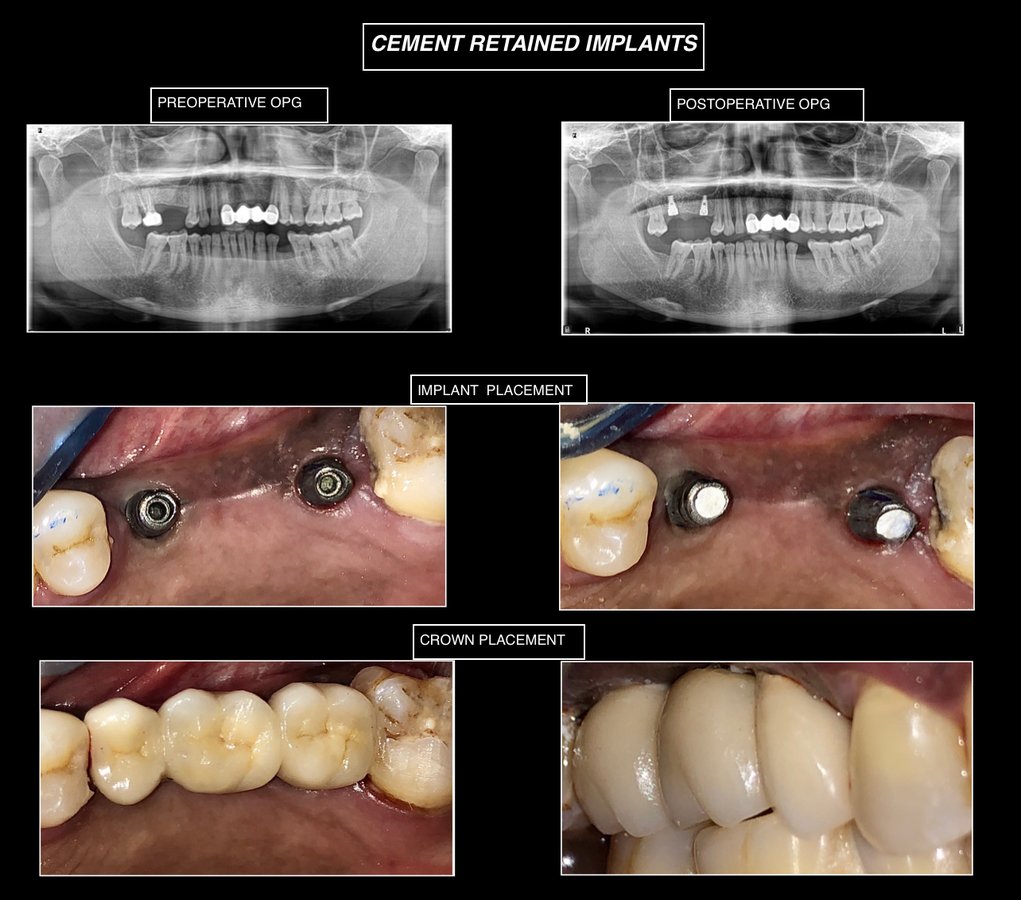 Raga Dental Center for Dental Implants & Laser - Raga Dental Center for Dental Implants & Laser