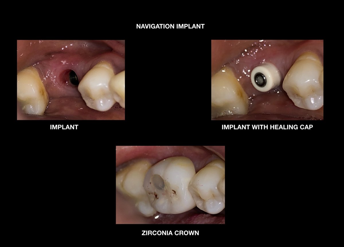 Raga Dental Center for Dental Implants & Laser - Raga Dental Center for Dental Implants & Laser