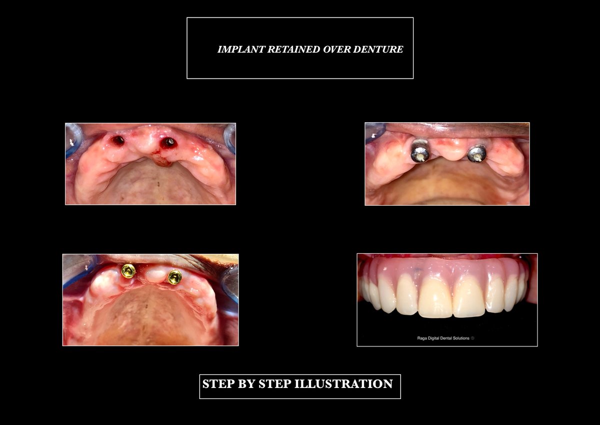 Raga Dental Center for Dental Implants & Laser - Raga Dental Center for Dental Implants & Laser