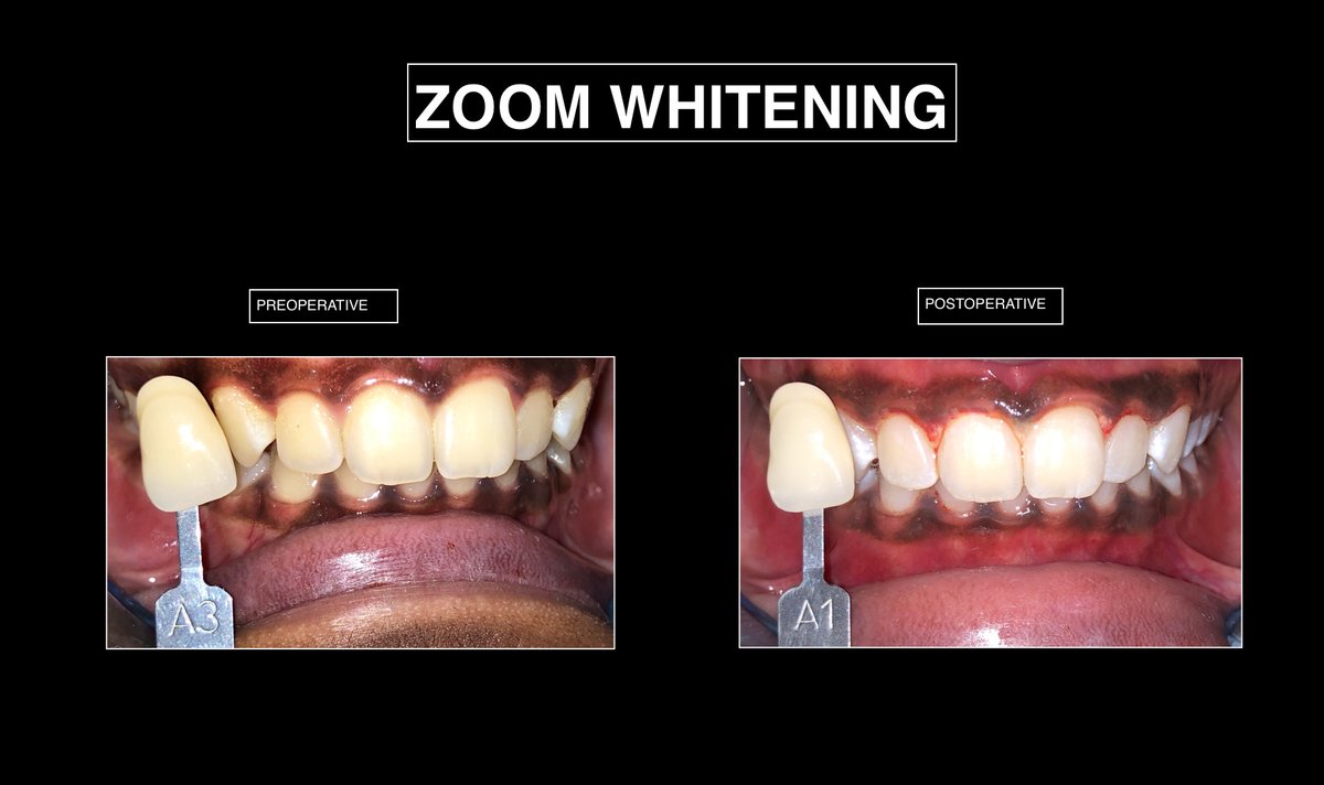 Raga Dental Center for Dental Implants & Laser - Raga Dental Center for Dental Implants & Laser