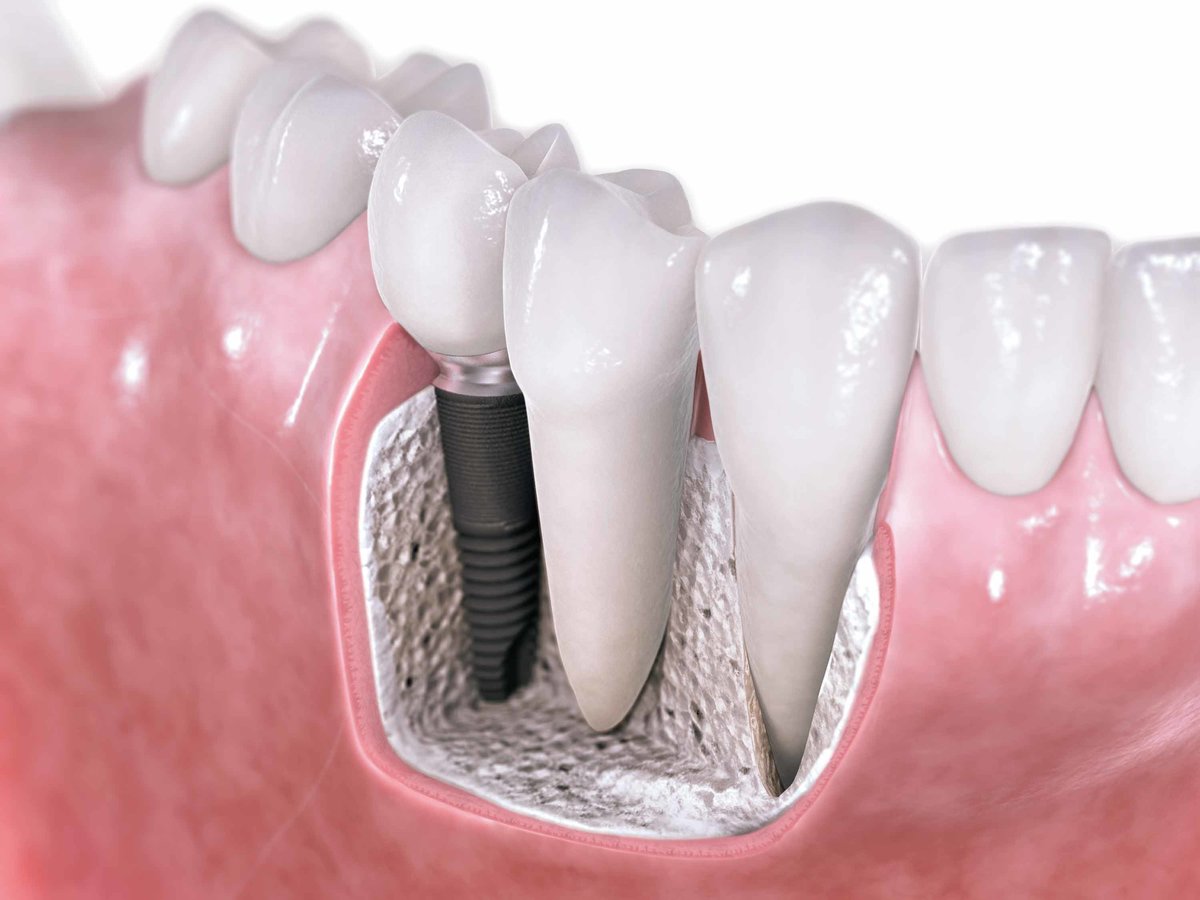 Rajaprabhu العناية بالأسنان - Rajaprabhu Dental Care