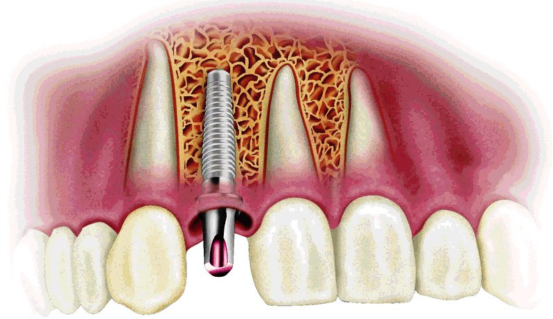 Rajaprabhu العناية بالأسنان - Rajaprabhu Dental Care