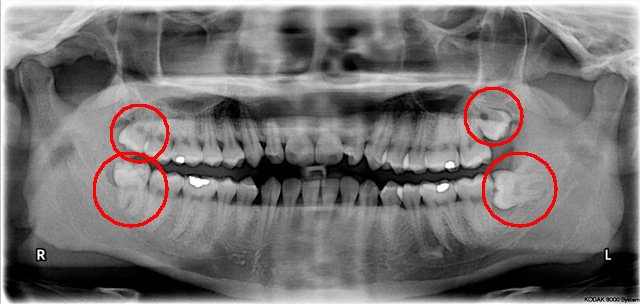 Rajaprabhu العناية بالأسنان - Rajaprabhu Dental Care