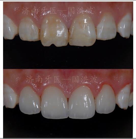 Rajaprabhu العناية بالأسنان - Rajaprabhu Dental Care