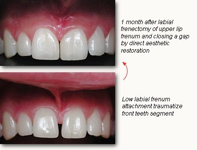 Rajaprabhu العناية بالأسنان - Rajaprabhu Dental Care