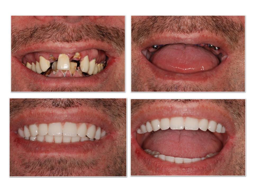Rajaprabhu العناية بالأسنان - Rajaprabhu Dental Care