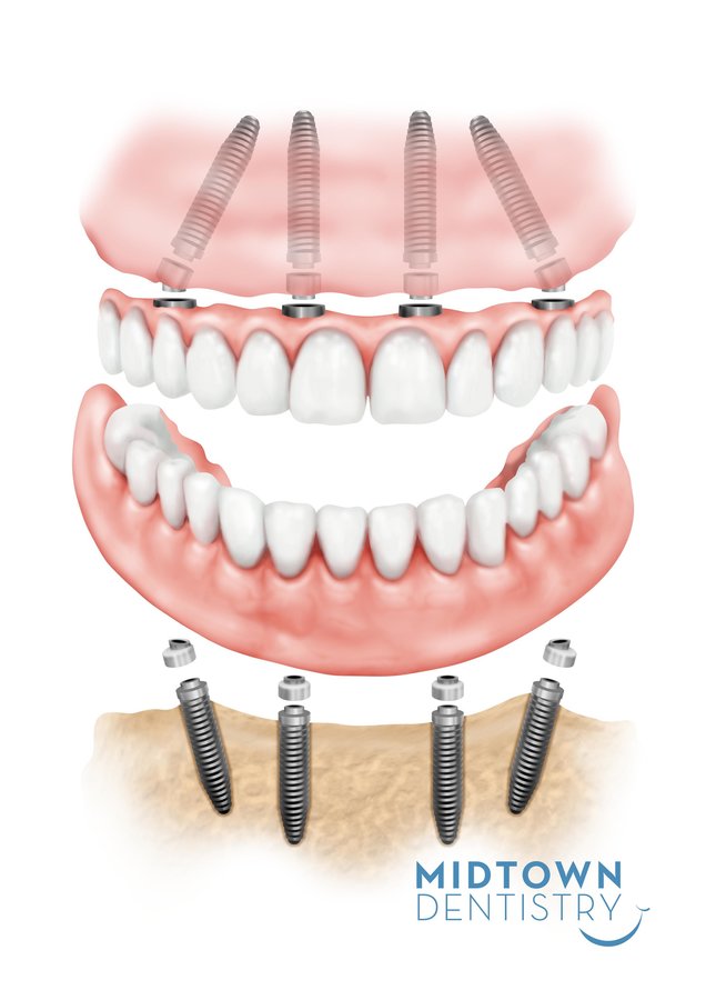 Rajaprabhu العناية بالأسنان - Rajaprabhu Dental Care