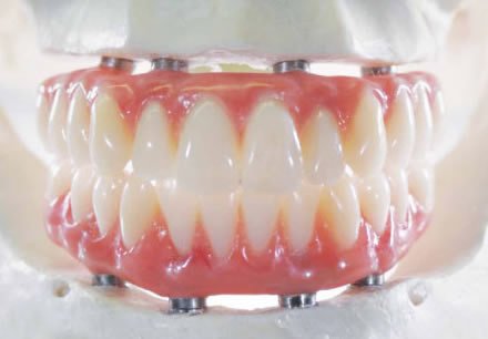 Rajaprabhu العناية بالأسنان - Rajaprabhu Dental Care