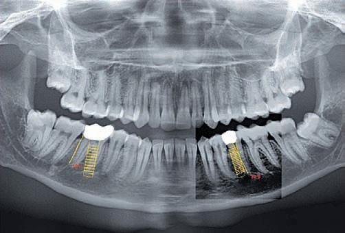 Rajaprabhu العناية بالأسنان - Rajaprabhu Dental Care