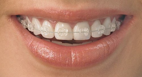 Rajaprabhu العناية بالأسنان - Rajaprabhu Dental Care