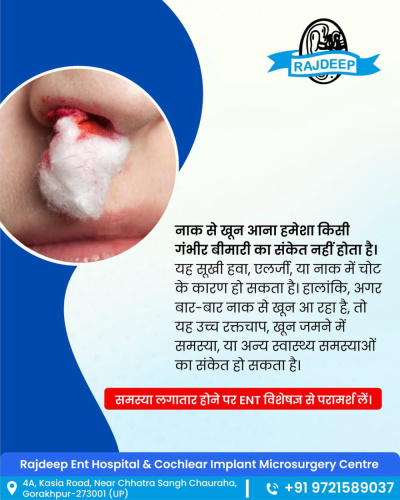 Rajdeep E.N.T. Hospital - Best ENT Hospital in Gorakhpur - Rajdeep E.N.T. Hospital - Best ENT Hospital in Gorakhpur