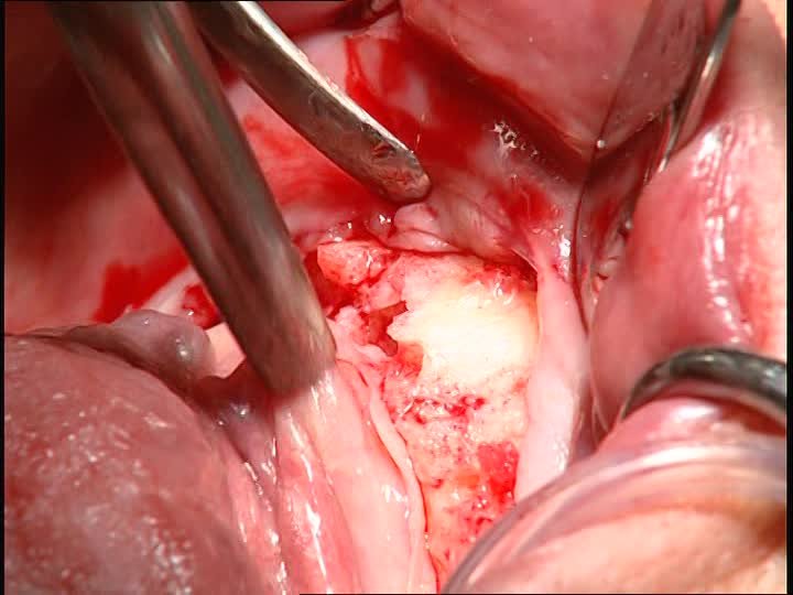 RAJKOT DENTAL - The Implant Centre - RAJKOT DENTAL - The Implant Centre