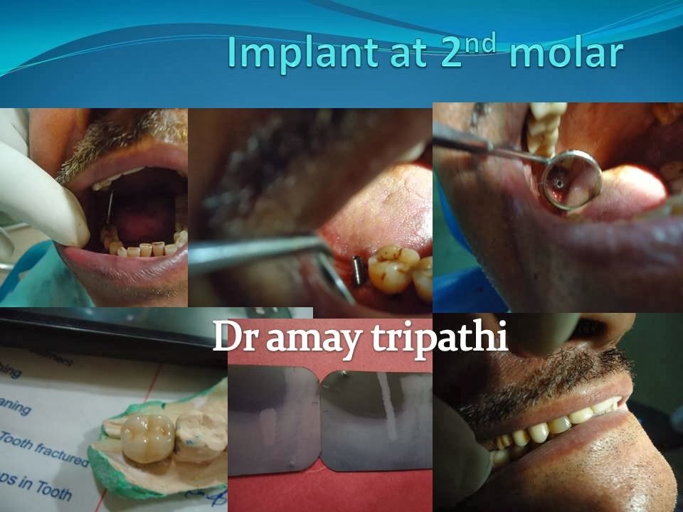 Rama Dental Clinic - Rama Dental Clinic