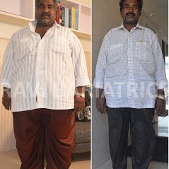 Ravi Bariatric and Obesity Clinic at Endocare - Ravi Bariatric and Obesity Clinic at Endocare