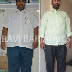 Ravi Bariatric and Obesity Clinic at Endocare - Ravi Bariatric and Obesity Clinic at Endocare