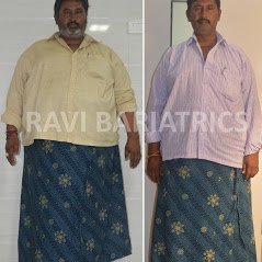 Ravi Bariatric and Obesity Clinic at Endocare - Ravi Bariatric and Obesity Clinic at Endocare