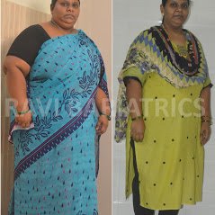 Ravi Bariatric and Obesity Clinic at Endocare - Ravi Bariatric and Obesity Clinic at Endocare