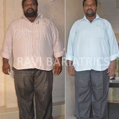 Ravi Bariatric and Obesity Clinic at Endocare - Ravi Bariatric and Obesity Clinic at Endocare