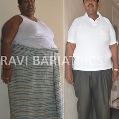 Ravi Bariatric and Obesity Clinic at Endocare - Ravi Bariatric and Obesity Clinic at Endocare