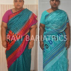 Ravi Bariatric and Obesity Clinic at Endocare - Ravi Bariatric and Obesity Clinic at Endocare
