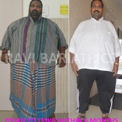 Ravi Bariatric and Obesity Clinic at Endocare - Ravi Bariatric and Obesity Clinic at Endocare