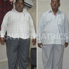 Ravi Bariatric and Obesity Clinic at Endocare - Ravi Bariatric and Obesity Clinic at Endocare