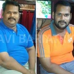 Ravi Bariatric and Obesity Clinic at Endocare - Ravi Bariatric and Obesity Clinic at Endocare