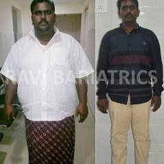 Ravi Bariatric and Obesity Clinic at Endocare - Ravi Bariatric and Obesity Clinic at Endocare
