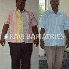 Ravi Bariatric and Obesity Clinic at Endocare - Ravi Bariatric and Obesity Clinic at Endocare
