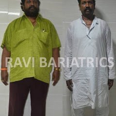 Ravi Bariatric and Obesity Clinic at Endocare - Ravi Bariatric and Obesity Clinic at Endocare